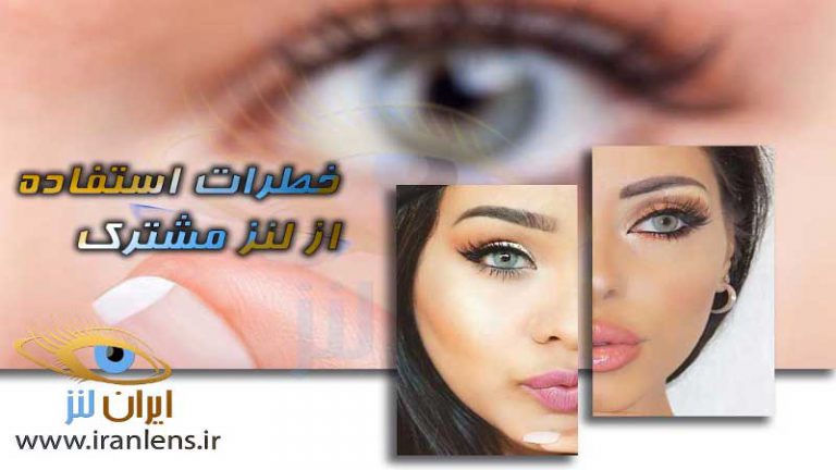 چرا نباید از لنز مشترک استفاده کنیم؟