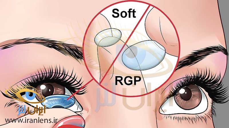 قیمت انواع لنز چشم نرم و لنز سخت