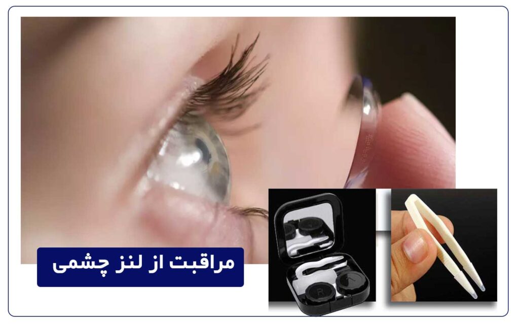 تضمین سلامت لنز چشمی با رعایت نکات مهم و کاربردی